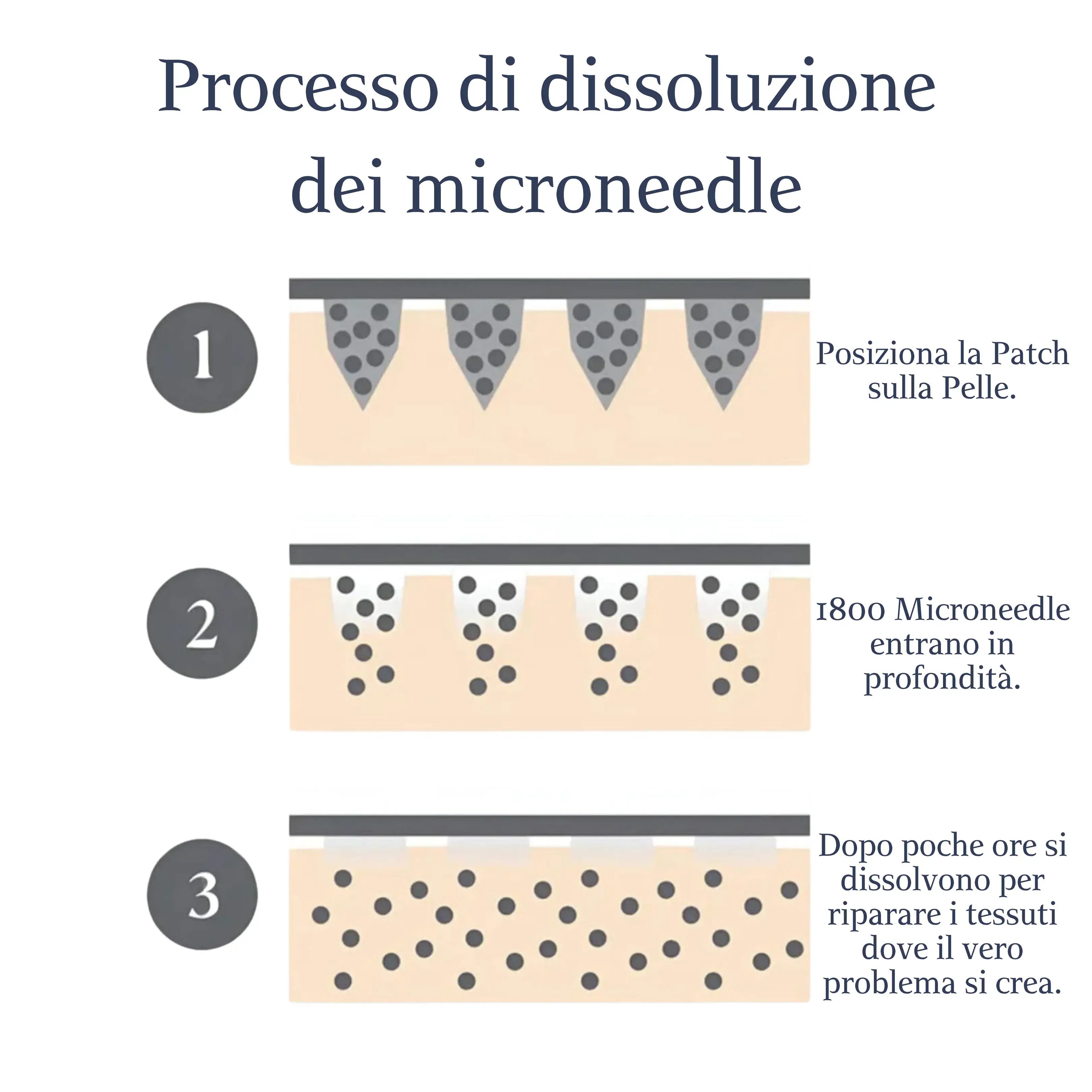Trattamento per la Riduzione di Occhiaie, Borse e Rughe con Infusione ai Microneedle